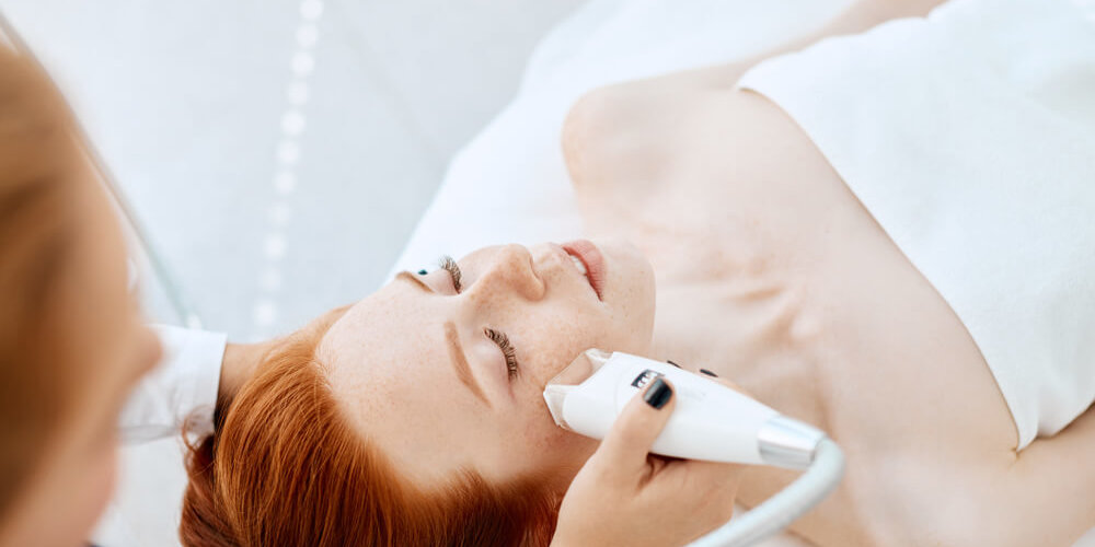 redheaded woman receiving IPL treatment