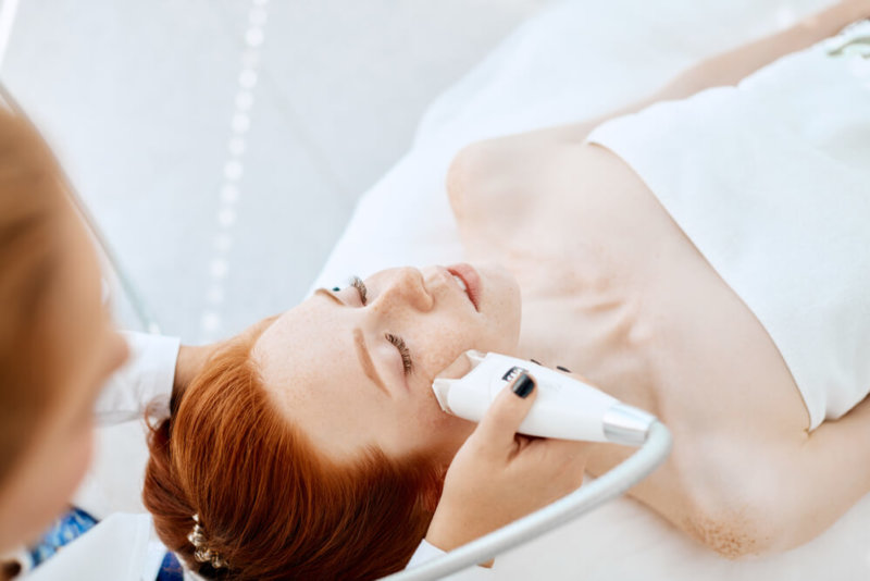 redheaded woman receiving IPL treatment